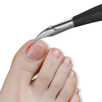 Паронихия, улучшенные кусачки для ногтей из нержавеющей стали, Триммер, профессиональный уход за вросшим педикюром, инструменты для обрезки ногтей на ногах